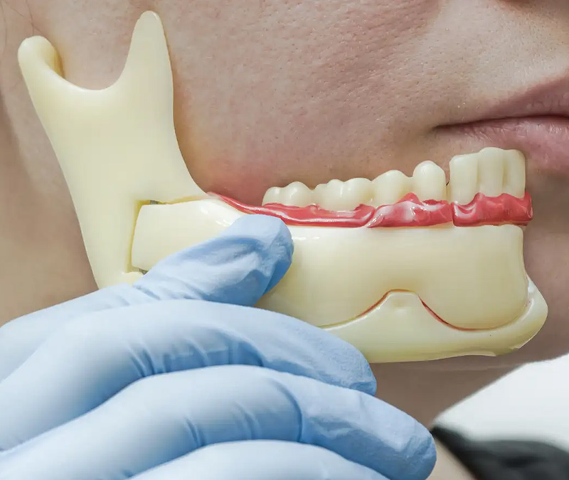 Dentist in Brantford at Conklin Family Dental performing bite adjustment and jaw alignment correction for a patient with TMJ issues.